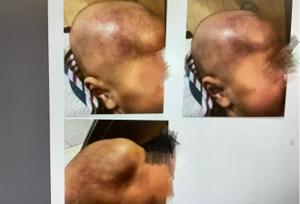 南加豪宅21幼童遭虐 照片触目惊心 男婴颅脑重伤