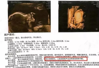 女子称彩超漏诊婴儿唇裂 到卫健委反映竟遭怒斥