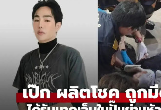 泰星peck在加油站被人用20厘米长刀具刺伤！目前嫌疑人已被捕