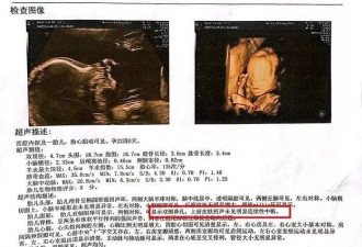 女子称医院彩超漏诊婴儿唇腭裂,到卫生健康委反映遭呵斥