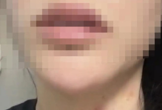 29岁女子疑被男友施暴后从25楼跳下身亡