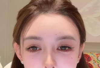 33岁叶珂真实状态曝光！医美后遗症好明显