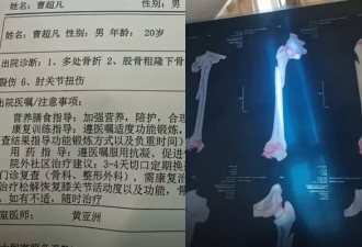 梦到被人追赶，开窗逃生 醒来人在半空