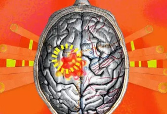 世界正变得愈来愈热，这如何影响我们的大脑