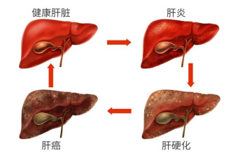 身体这6种“预警信号” 小心拖成癌