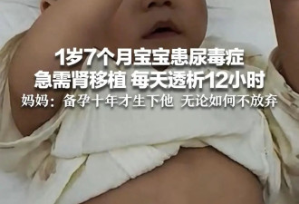 女子备孕10年生下宝宝患尿毒症 每天透析12小时