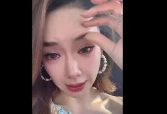 戚薇大方承认过度医美：打肉毒打僵，整个眉毛完全动不了