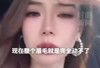 戚薇大方承认医美过度：打僵了，整个眉毛完全动不了