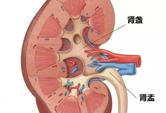 “肾结石”最喜欢的习惯 希望你没有