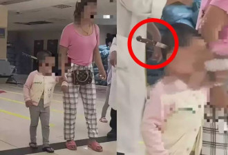 云南女童“头上插刀 ”淡定就医 母亲说法反复惹议