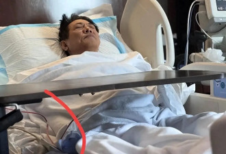 李连杰手术过程曝光价值两亿佛珠不离手，报平安才肯摘下，网友评论一针见血