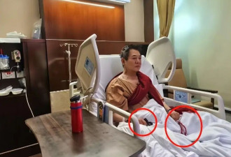 李连杰手术过程曝光价值两亿佛珠不离手，报平安才肯摘下，网友评论一针见血