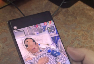 “身首离断”被救回引关注！主刀医生讲述从医30多年最凶险情况