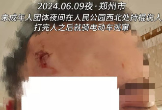 郑州围殴同性恋案：拉拉女卧底取证 却被拘留至今