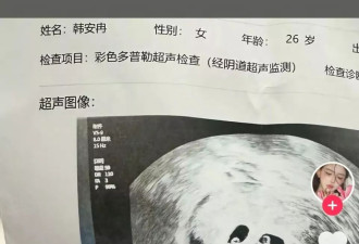 韩安冉自曝三胎引产，或因整形全麻导致胎儿发育问题