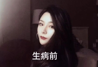 跑一天外卖，换一天生命，尿毒症晚期女生与病魔斗争4年