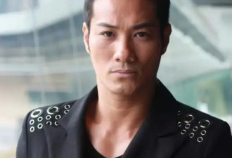 香港知名男星被砍留后遗症 脸皮险被砍掉 身上多处刀疤清晰可见