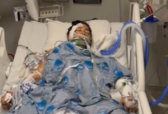 士嘉堡女留学生遭"毁灭性"车祸: 肝脏切除+多处骨折! 绝望求助