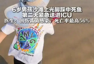 小心！男孩踩到死鱼被送进ICU
