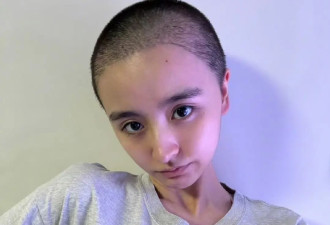女艺人金子涵退圈后剃寸头，身体状态惹人担忧