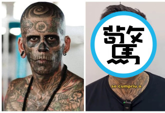 比刺青痛3倍！男洗掉全身95%刺青 重生样貌曝光