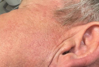 “地狱厨神”Gordon Ramsay证实患癌 网友却笑了