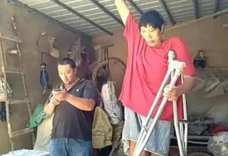 35岁山东巨人去世 身高2.4米 街头筹钱做手术