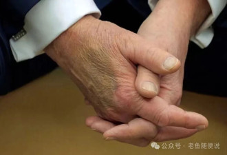 一周没露面，似戴尿不湿，川普摊上大事了？