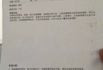 自由以后，我决定写下2020年的武汉，我们全家感染