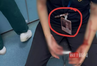 女子被男同事持水杯砸伤面部缝20多针：医药费自己垫付