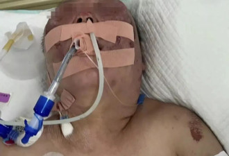 被前夫打进ICU的女子死亡 大女儿：希望严惩凶手