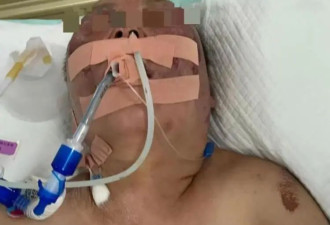 被前夫打进ICU女子不幸去世，还有谁该担责？