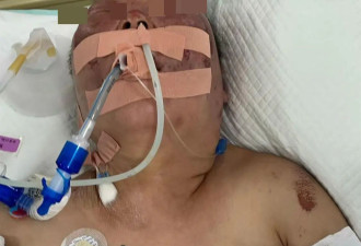 律师谈"女子被前夫殴打致死"：凶手最高可判死刑