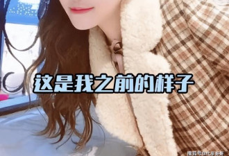 24岁北电校花酒后昏迷 醒来后容貌大变