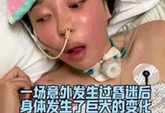 24岁北电校花酒后昏迷 醒来后容貌大变