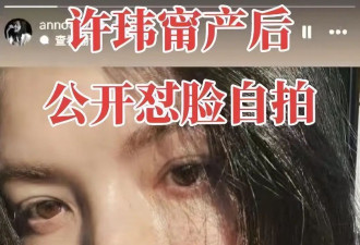 许玮甯产后21天复工！41岁状态惊艳，被网友狂赞是“骨相美人”