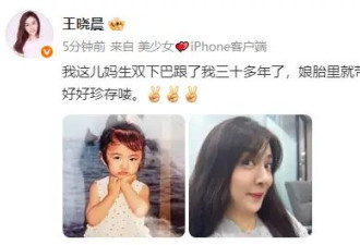王晓晨晒童年照回应近照双下巴明显：娘胎里就带的，是爸妈给的福气