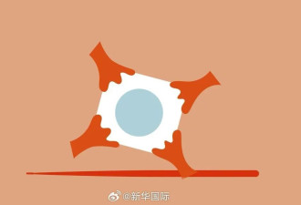 失明20多年 加顶尖高校“以牙换眼”让他重见光明