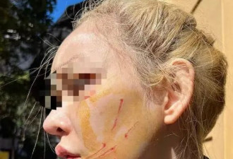 中国女网红澳洲餐厅遭暴力殴打，华人热议