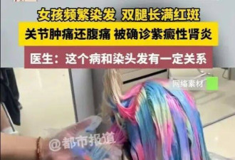太疯狂！00后女生频染发双腿长满红斑 确诊肾炎
