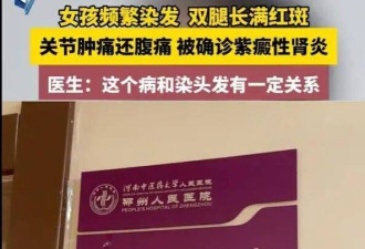 太疯狂！00后女生频染发双腿长满红斑 确诊肾炎