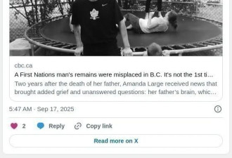 惊悚！BC省男子死后大脑竟"消失"了两年