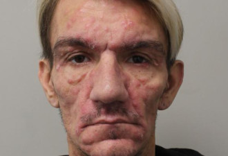HIV男“4年约炮400男” 警急寻318名受害者