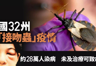 美国32州传“接吻虫”疫情 料28万人染病 或可致命