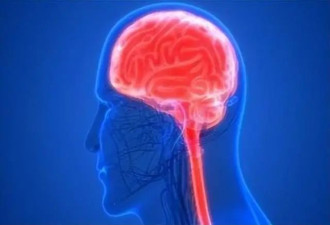 脑干一旦出血 死亡率竟高达50%
