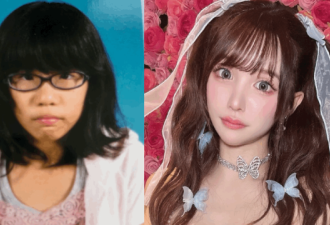 女子攒2600万整容换头:可爱脸比铂金包珍贵