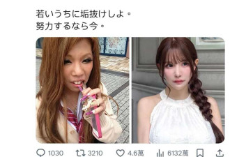 女子攒2600万整容换头:可爱脸比铂金包珍贵