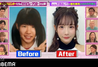 女子攒2600万整容换头:可爱脸比铂金包珍贵