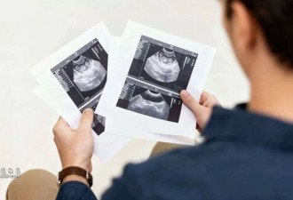 医生坦言:7种你以为的“大病”,其实不用担心