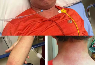 以前是我抢救别人，但这次，我被抢救